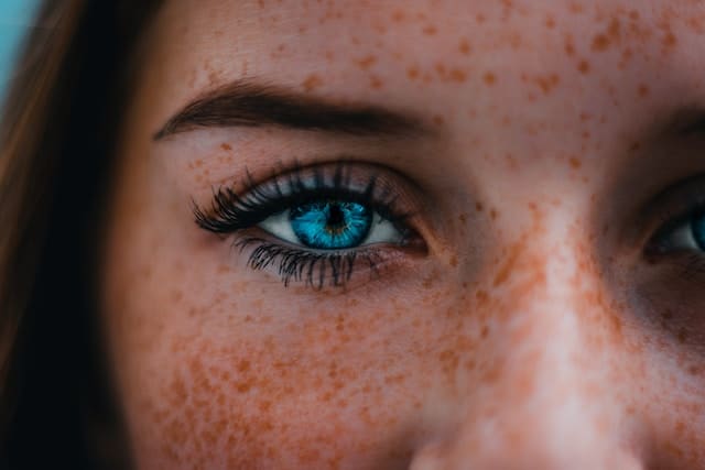 Close-up of person with freckles showing one blue eye and part of face in soft focus